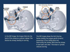 Anti-Snore Tongue Stabilizing Device Non-Invasive Nighttime Support