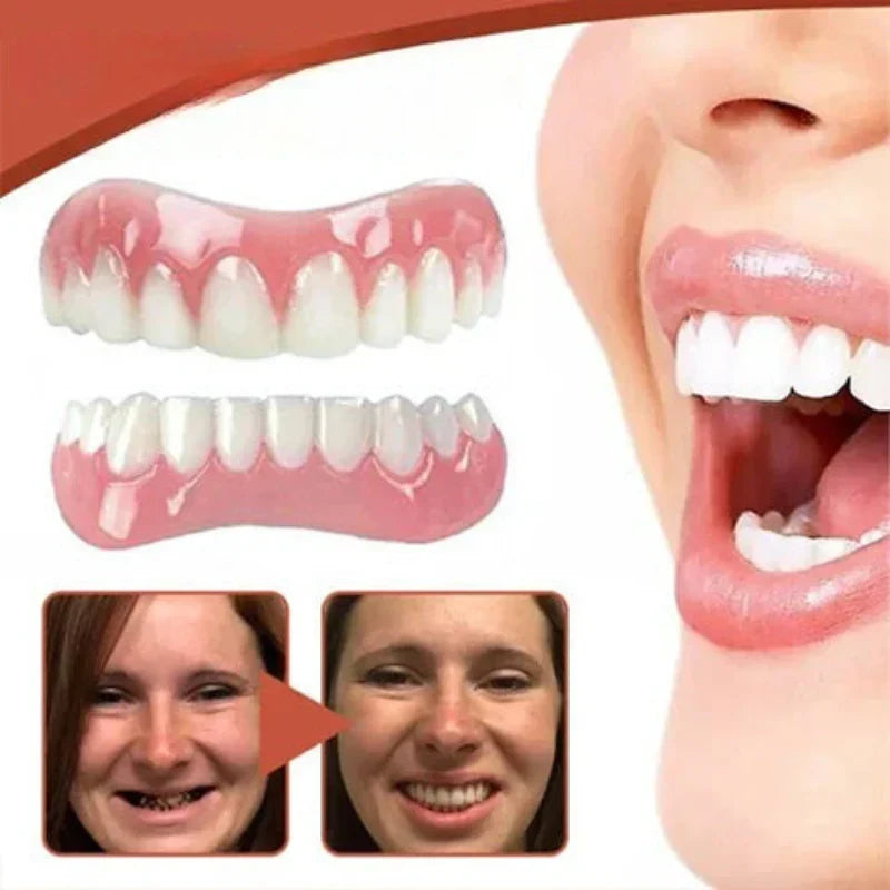 Snap On Veneers Custom Fit - Image 4