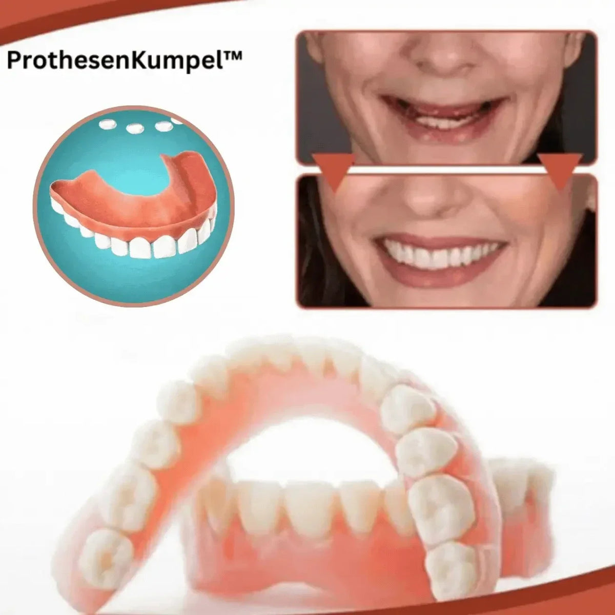 Snap On Veneers Custom Fit - Image 6